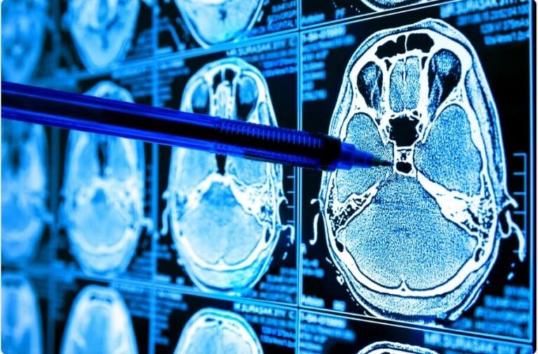 تشخیص نشانه‌های بیماری در اسکن‌های MRI با هوش مصنوعی